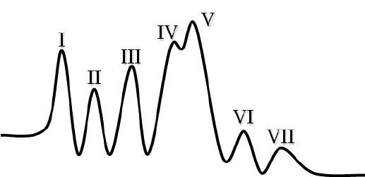Sample BAER waveforms from a patient with normal hearing